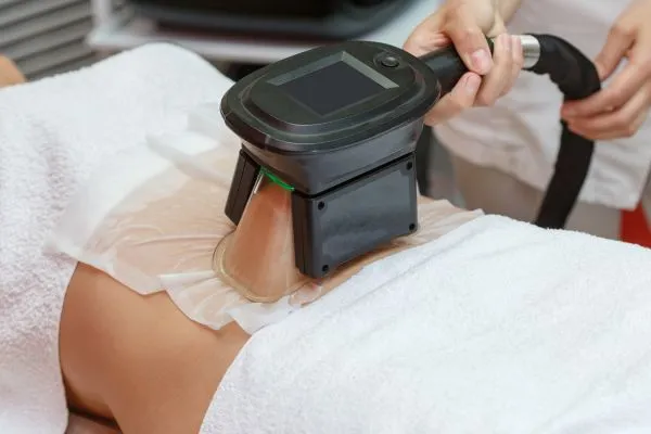 Image of person having fat freezing treatment to help weight gain Bromyard