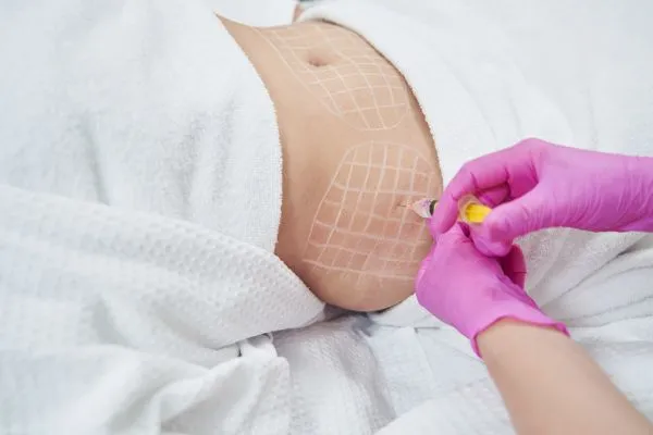 image of fat dissolving injections on love handles to help combat weight gain Bromyard