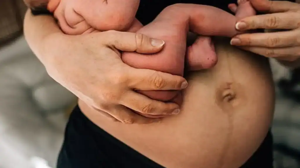 Why Is My Stomach Still Big After Pregnancy Bromyard?